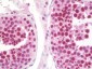 CCNT1 / Cyclin T1 Antibody (C-Terminus)